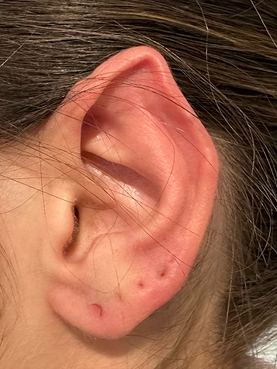 img casos exito remodelacion oreja before 390x520
